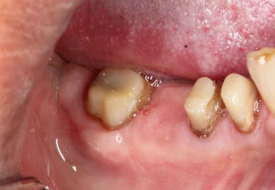 before-biologic-shaping