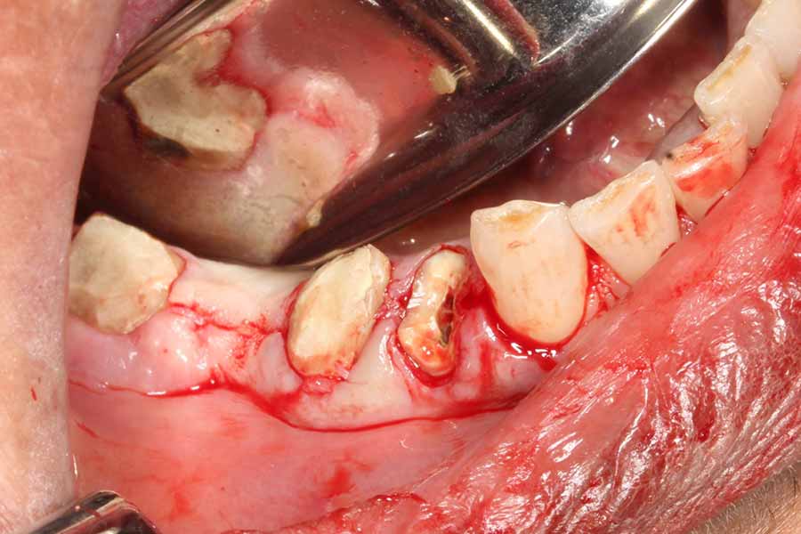 biologic-shaping
